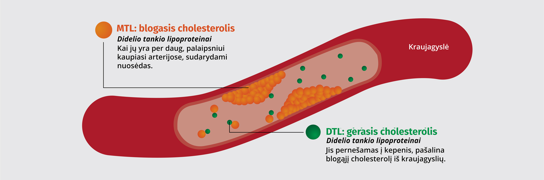 MTL ir DTL cholesterolis